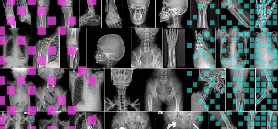 Can AI Replace Doctors Who Read X-Rays?